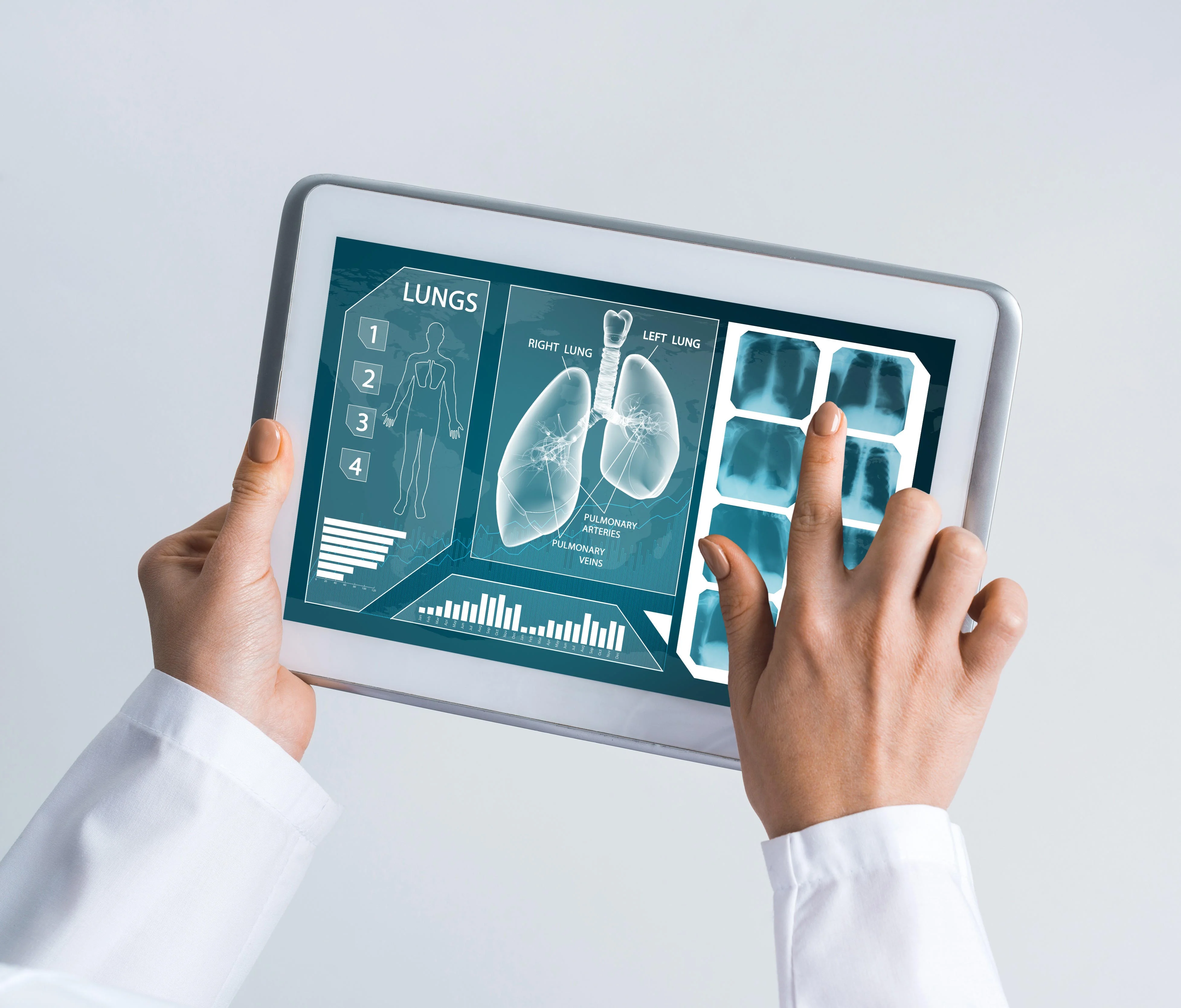 Touch Screen Integration Solutions application